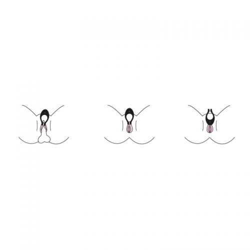 Partner Multifun 2 - Vibratore Multifunzione Satisfyer